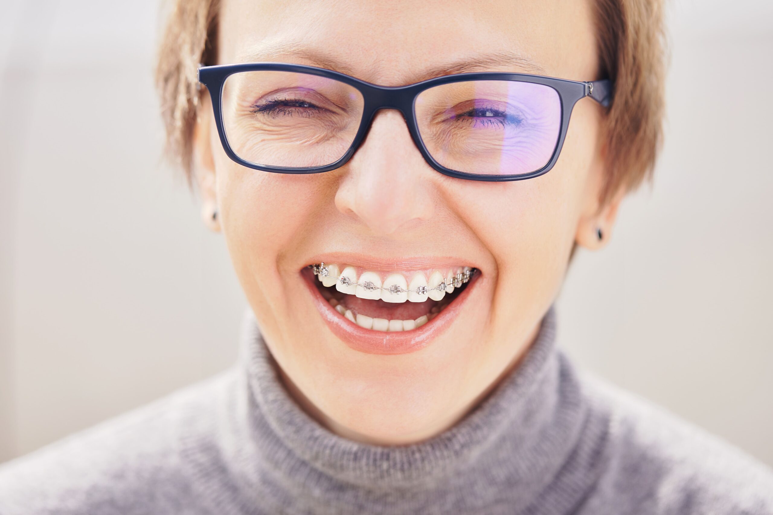 braces orthodontist for adults near me